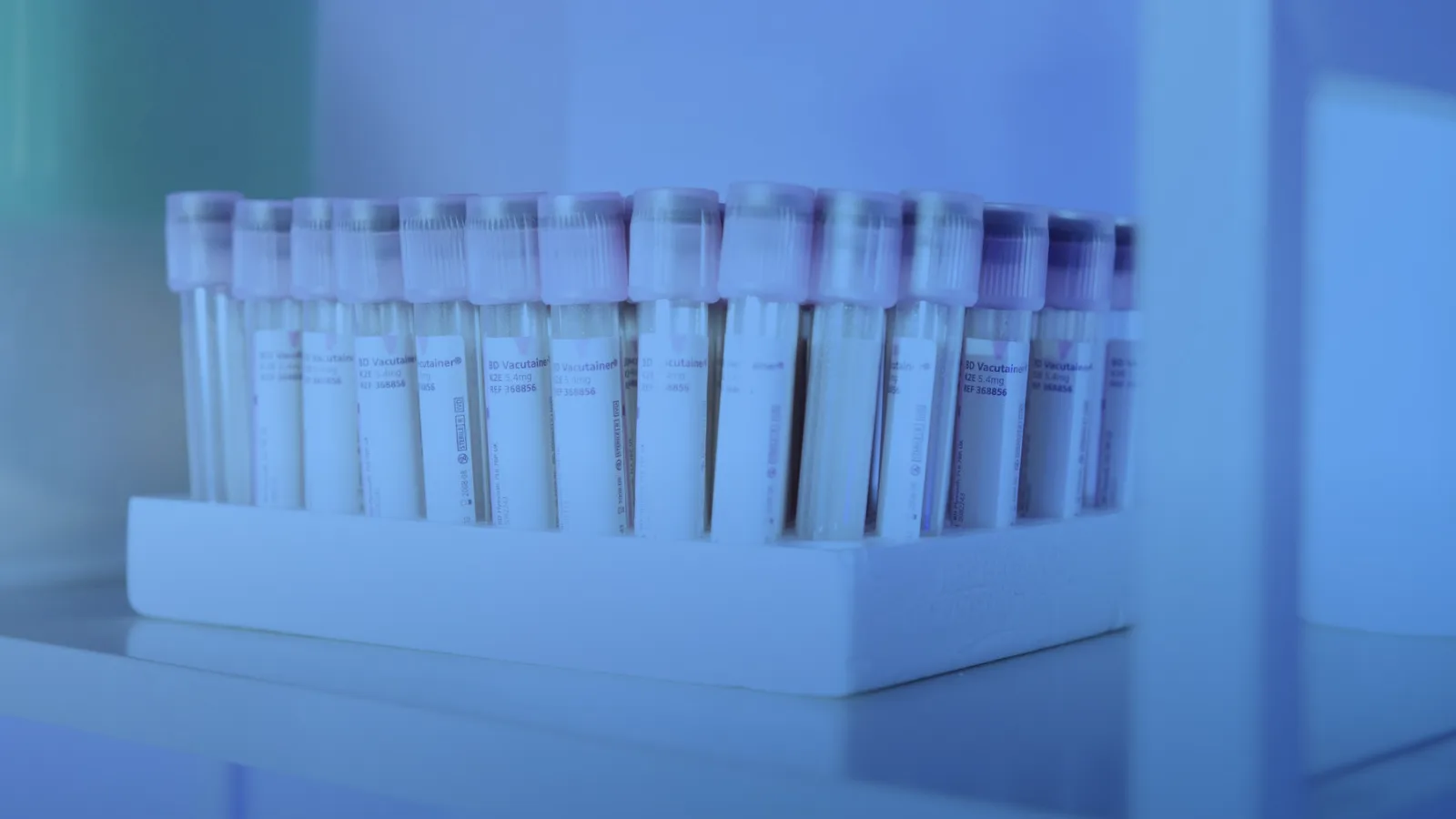 Tubos de ensayo con tapa rosada ordenados en una gradilla de laboratorio